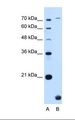 TMEM91 Antibody - Lane A: Marker. Lane B: HepG2 cell lysate. Antibody concentration: 1.0 ug/ml. Gel concentration: 12%.  This image was taken for the unconjugated form of this product. Other forms have not been tested.