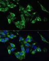 TMEPAI / PMEPA1 Antibody - Immunofluorescence analysis of U2OS cells using PMEPA1 antibody at dilution of 1:100. Blue: DAPI for nuclear staining.