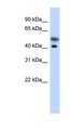 TMOD2 / Tropomodulin 2 Antibody - TMOD2 / Tropomodulin 2 antibody Western blot of Transfected 293T cell lysate. This image was taken for the unconjugated form of this product. Other forms have not been tested.