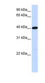 TMOD3 / Tropomodulin 3 Antibody - TMOD3 / Tropomodulin 3 antibody Western blot of Fetal Lung lysate. This image was taken for the unconjugated form of this product. Other forms have not been tested.