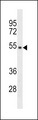 TMPPE Antibody - TMPPE Antibody western blot of HepG2 cell line lysates (35 ug/lane). The TMPPE antibody detected the TMPPE protein (arrow).