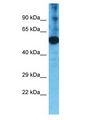 TMPRSS11F Antibody - TMPRSS11F antibody Western Blot of Fetal Liver. Antibody dilution: 1 ug/ml.  This image was taken for the unconjugated form of this product. Other forms have not been tested.