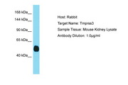 TMPRSS3 Antibody -  This image was taken for the unconjugated form of this product. Other forms have not been tested.