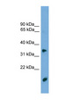 TMPRSS3 Antibody - TMPRSS3 antibody Western blot of Jurkat lysate. This image was taken for the unconjugated form of this product. Other forms have not been tested.