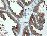 TMPRSS5 Antibody - IHC of paraffin-embedded Human prostate tissue using anti-TMPRSS5 mouse monoclonal antibody. (Heat-induced epitope retrieval by 10mM citric buffer, pH6.0, 120°C for 3min).