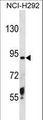 TMPRSS6 Antibody - TMPRSS6 Antibody western blot of NCI-H292 cell line lysates (35 ug/lane). The TMPRSS6 antibody detected the TMPRSS6 protein (arrow).
