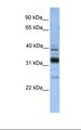 TMX4 Antibody - Fetal liver lysate. Antibody concentration: 1.0 ug/ml. Gel concentration: 12%.  This image was taken for the unconjugated form of this product. Other forms have not been tested.