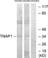 TNFAIP1 Antibody - Western blot analysis of lysates from HUVEC cells, treated with PMA 125ng/ml 30', using TNAP1 Antibody. The lane on the right is blocked with the synthesized peptide.