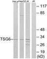 TNFAIP6 / TSG-6 Antibody - Western blot analysis of lysates from Jurkat, HeLa, and HepG2 cells, using TSG6 Antibody. The lane on the right is blocked with the synthesized peptide.