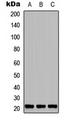 TNFAIP8L1 Antibody - Western blot analysis of TNFAIP8L1 expression in MCF7 (A); Raw264.7 (B); PC12 (C) whole cell lysates.