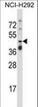 TNFRSF10A / DR4 Antibody - TNFRSF10A Antibody western blot of NCI-H292 cell line lysates (35 ug/lane). The TNFRSF10A antibody detected the TNFRSF10A protein (arrow).