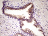 TNFRSF10B / Killer / DR5 Antibody - IHC of paraffin-embedded Human prostate tissue using anti-TNFRSF10B mouse monoclonal antibody. (Heat-induced epitope retrieval by 1 mM EDTA in 10mM Tris, pH8.5, 120°C for 3min).
