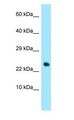 TNFRSF17 / BCMA Antibody - TNFRSF17 / BCMA antibody Western Blot of Human heart.  This image was taken for the unconjugated form of this product. Other forms have not been tested.
