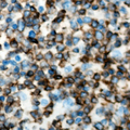 TNFRSF19L / RELT Antibody - Immunohistochemical analysis of RELT staining in human lymph node formalin fixed paraffin embedded tissue section. The section was pre-treated using heat mediated antigen retrieval with sodium citrate buffer (pH 6.0). The section was then incubated with the antibody at room temperature and detected using an HRP conjugated compact polymer system. DAB was used as the chromogen. The section was then counterstained with hematoxylin and mounted with DPX.