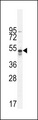 TNFRSF1A / TNFR1 Antibody - hTNFR-pS274 western blot of A549 cell line lysates (35 ug/lane). The TNFR antibody detected the TNFR protein (arrow).