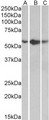 TNFRSF1A / TNFR1 Antibody - Goat Anti-TNFRSF1A Antibody (0.5µg/ml) staining of A549 (A), HepG2 (B) and K562 (C) lysates (35µg protein in RIPA buffer). Primary incubation was 1 hour. Detected by chemiluminescencence.