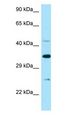 TNFRSF1B / TNFR2 Antibody - TNFRSF1B / TNFR2 / p75 antibody Western Blot of OVCAR-3.  This image was taken for the unconjugated form of this product. Other forms have not been tested.