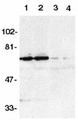 TNFRSF21 / DR6 Antibody - Western blot of DR6 in K562 (1,3) and Raji (2,4) whole cell lysate in the absence (1,2) or presence (3,4) of blocking peptide (Catalog no. 2157P) with DR6 antibody at 1:500 dilution.