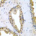 TNFSF10 / TRAIL Antibody - Immunohistochemistry of paraffin-embedded human prostate.