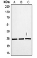 TNFSF12 / TWEAK Antibody - Western blot analysis of TWEAK expression in SKNSH (A); WI38 (B); HUVEC (C) whole cell lysates.
