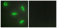 TNFSF14 / LIGHT Antibody - Immunofluorescence analysis of HeLa cells, using TNF14 Antibody. The picture on the right is blocked with the synthesized peptide.