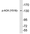 TNK2 / ACK1 Antibody - Western blot analysis of lysates from HepG2 cells treated with EGF, using phospho-ACK (Phospho-Tyr518) antibody.