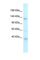 TNKS / Tankyrase Antibody - TNKS / Tankyrase antibody Western blot of Rat Lung lysate. Antibody concentration 1 ug/ml.  This image was taken for the unconjugated form of this product. Other forms have not been tested.