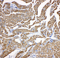 TNNC1 / Cardiac Troponin C Antibody - TNNC1 / Cardiac Troponin C antibody. IHC(P): Rat Cardiac Muscle Tissue.