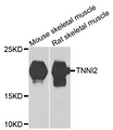TNNI2 Antibody - Western blot analysis of extracts of various cells.