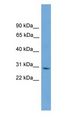 TNRC5 / CNPY3 Antibody - TNRC5 / CNPY3 antibody Western Blot of Human Placenta.  This image was taken for the unconjugated form of this product. Other forms have not been tested.
