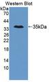 TNRC6A / GW182 Antibody - Western blot of TNRC6A / GW182 antibody.