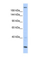 TNRC6B Antibody - TNRC6B antibody Western blot of Fetal Brain lysate. This image was taken for the unconjugated form of this product. Other forms have not been tested.