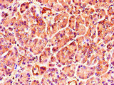 TNRC6C Antibody - Immunohistochemistry of paraffin-embedded human pancreatic tissue using TNRC6C Antibody at dilution of 1:100