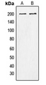 TNS1 / Tensin-1 Antibody - Western blot analysis of Tensin 1 (pY1326) expression in A10 (A); HeLa (B) whole cell lysates.