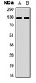 TNS2 / TENC1 Antibody - Western blot analysis of Tensin 2 expression in A549 (A); NIH3T3 (B) whole cell lysates.