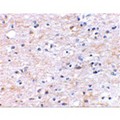 TOCA1 / FNBP1L Antibody - Immunohistochemical staining of human brain tissue using TOCA-1 antibody at 2.5 µg/mL.