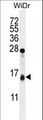 TOMM20L Antibody - TOMM20L Antibody western blot of WiDr cell line lysates (35 ug/lane). The TOMM20L antibody detected the TOMM20L protein (arrow).