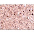 TOMM70A Antibody - Immunohistochemistry of TOM70 in mouse brain tissue with TOM70 antibody at 2.5 µg/mL.