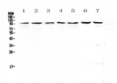 TOP1 / Topoisomerase I Antibody - Western blot - Anti-Topoisomerase I antibody