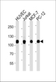 TOP1 / Topoisomerase I Antibody - Western blot of lysates from HUVEC, Jurkat, MCF-7, PC-12 cell line (from left to right) with TOP1 Antibody. Antibody was diluted at 1:1000 at each lane. A goat anti-mouse IgG H&L (HRP) at 1:5000 dilution was used as the secondary antibody. Lysates at 35 ug per lane.