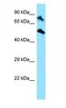 TOP1MT Antibody - TOP1MT antibody Western Blot of HepG2.  This image was taken for the unconjugated form of this product. Other forms have not been tested.