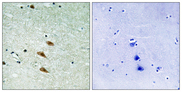 TOP2A / Topoisomerase II Alpha Antibody - Immunohistochemistry analysis of paraffin-embedded human brain tissue, using TOP2A Antibody. The picture on the right is blocked with the synthesized peptide.