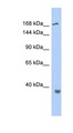 TOP2B / Topoisomerase II Beta Antibody - TOP2B antibody Western blot of Fetal Stomach lysate. This image was taken for the unconjugated form of this product. Other forms have not been tested.