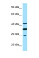 TOR1A / Torsin A Antibody - TOR1A / Torsin A antibody Western blot of Fetal Brain lysate. Antibody concentration 1 ug/ml.  This image was taken for the unconjugated form of this product. Other forms have not been tested.