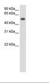 TOR3A Antibody - Transfected 293T Cell Lysate.  This image was taken for the unconjugated form of this product. Other forms have not been tested.