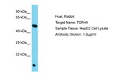 TOR4A / C9orf167 Antibody -  This image was taken for the unconjugated form of this product. Other forms have not been tested.