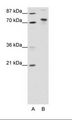 TOX4 / C14orf92 Antibody - A: Marker, B: Transfected 293T Cell Lysate.  This image was taken for the unconjugated form of this product. Other forms have not been tested.