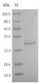 TES26/26 kDa Secreted Antigen Protein - (Tris-Glycine gel) Discontinuous SDS-PAGE (reduced) with 5% enrichment gel and 15% separation gel.