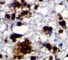 Toxoplasma gondii Antibody - IHC of Toxoplasma gondii on FFPE Brain tissue. This image was taken for the unmodified form of this product. Other forms have not been tested.
