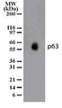 TP63 / p63 Antibody - Western blot analysis of p63 on A549 lysate (20 ug/lane) using antibody at a concentration of 3 ug/ml